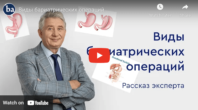 Яшков Юрий Иванович о бариатрических операциях